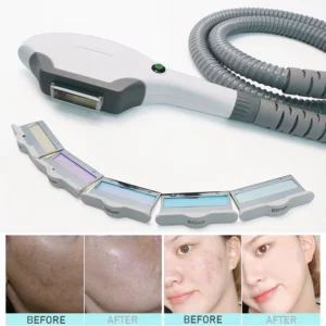 IPL hair removal photo facial machine 2