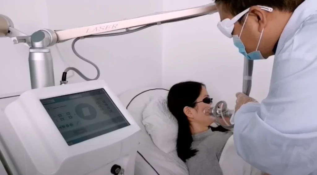 Carbon Dioxide Fractional Laser in skin resurfacing