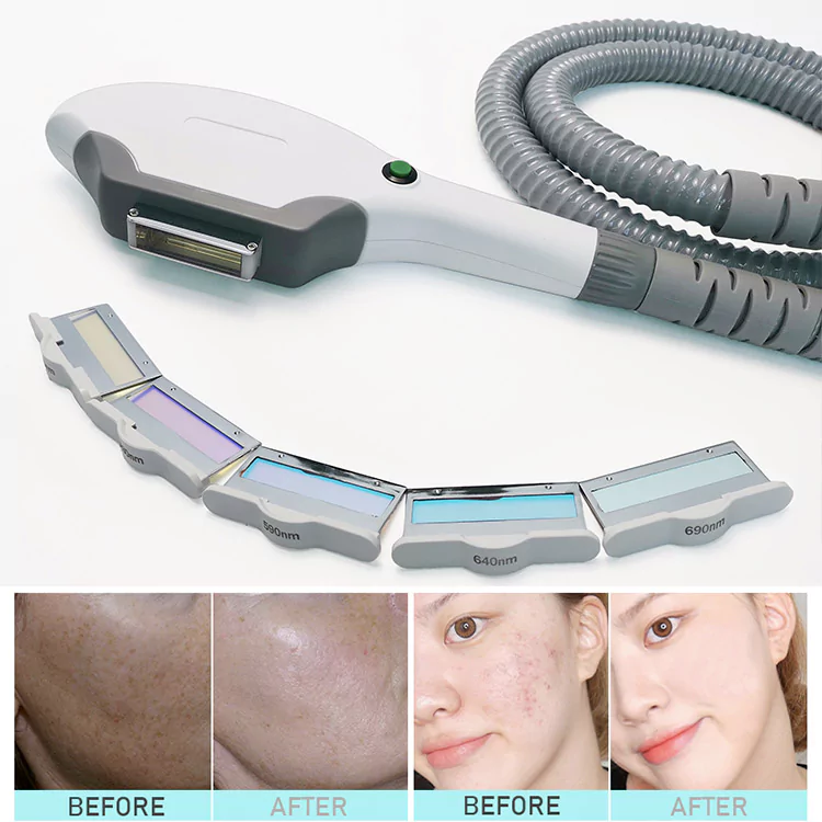 IPL hair removal photo facial machine