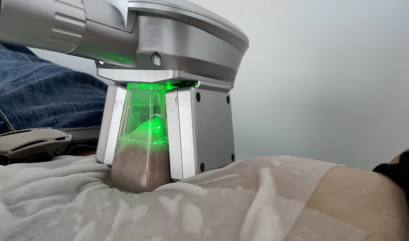 cryolipolysis slimming treatment