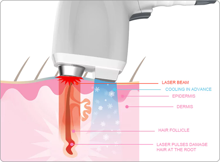 ice diode laser double cooling system
