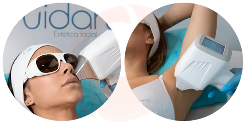 latest diode laser hair removal machine in treatment