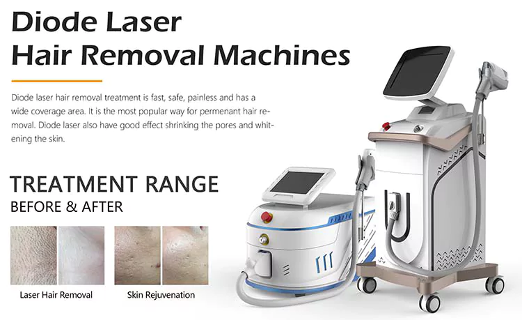 diode laser best for hair removal machine
