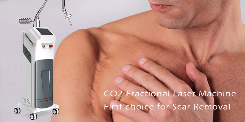 scar removal machine co2 laser