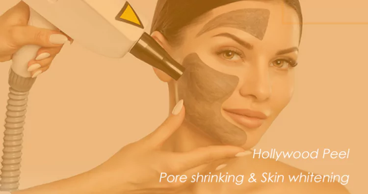 tattoo removal carbon peel laser 1